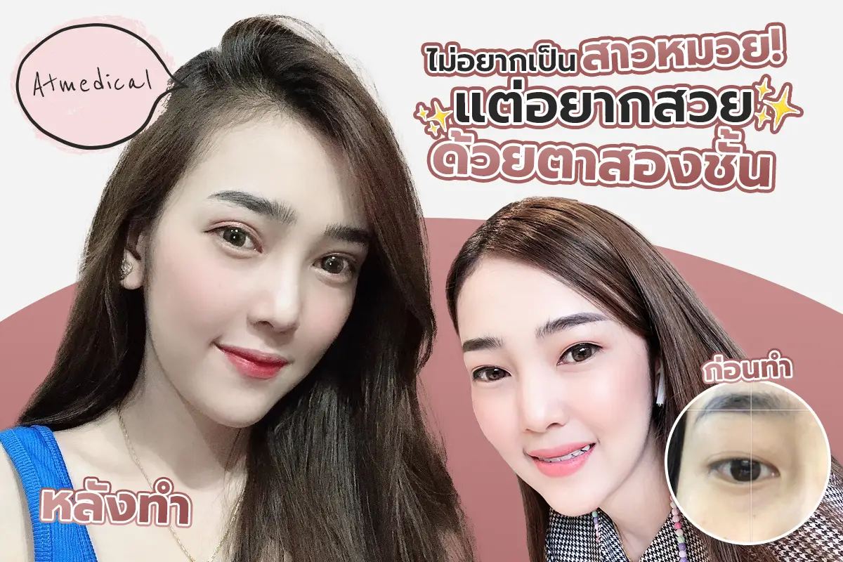 รีวิว ไม่อยากเป็นสาวหมวย แต่อยากสวยด้วยตาสองชั้น