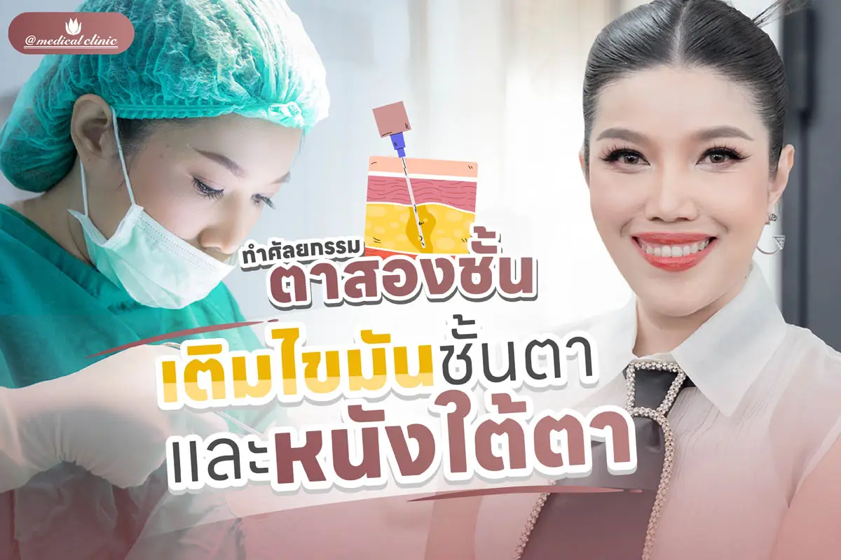 ศัลยกรรมตาสองชั้น เติมไขมัน