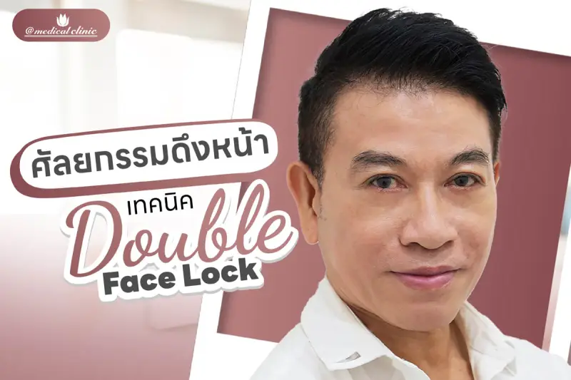 ศัลยกรรมดึงหน้า เทคนิค Double Face Lock